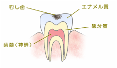 う触第1度 う触第1度
