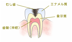 う触第2度 う触第2度