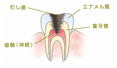 う触第3度 う触第3度