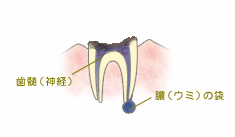 う触第4度 う触第4度